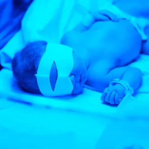 Phototherapy Baby eyepatches