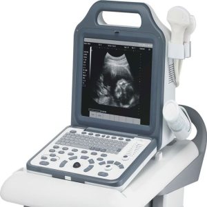 Portable Digital Laptop Ultrasound Scanner